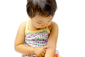 小児アトピー性皮膚炎のイメージ写真